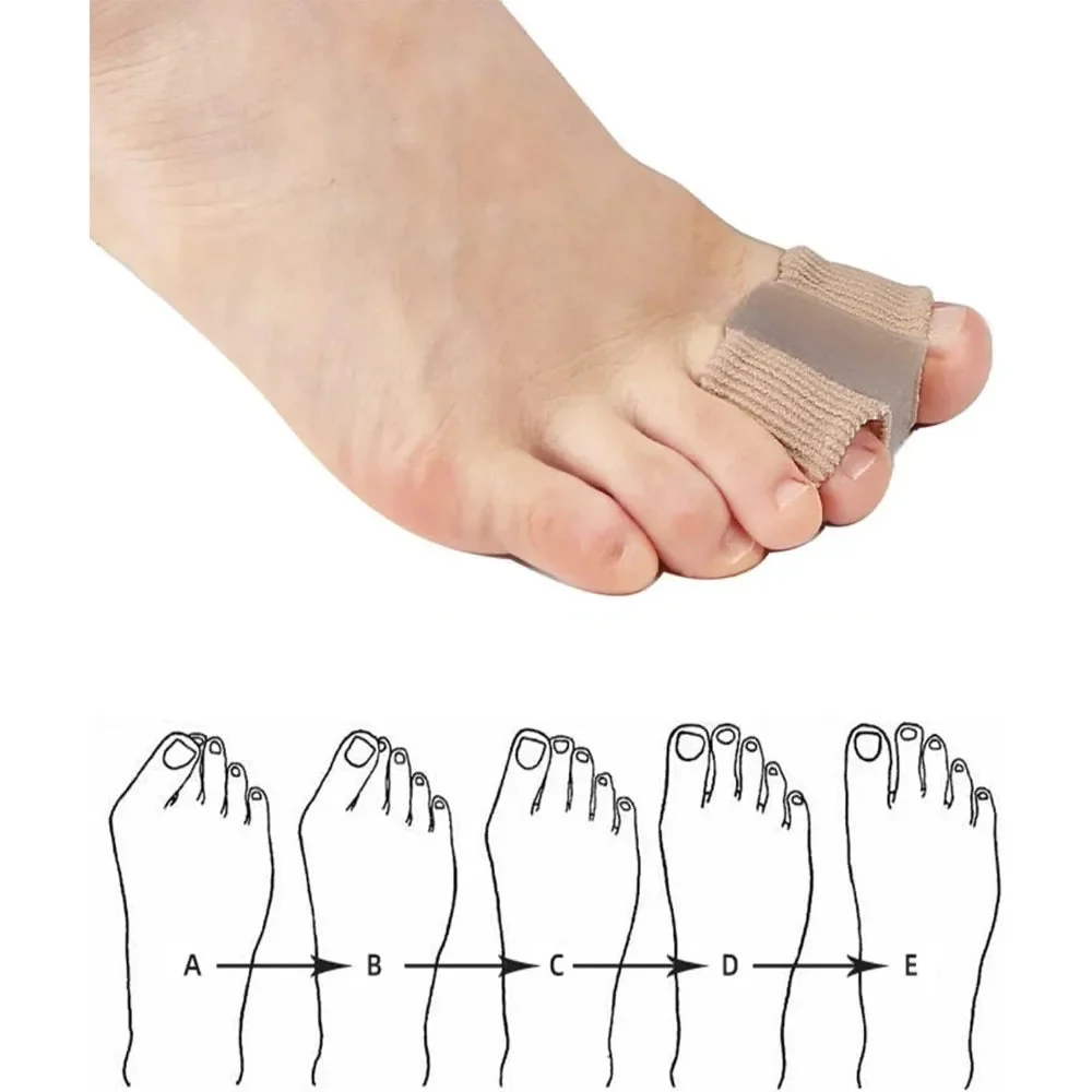 Ecarteur d'orteils Hallux Valgus – Image 8