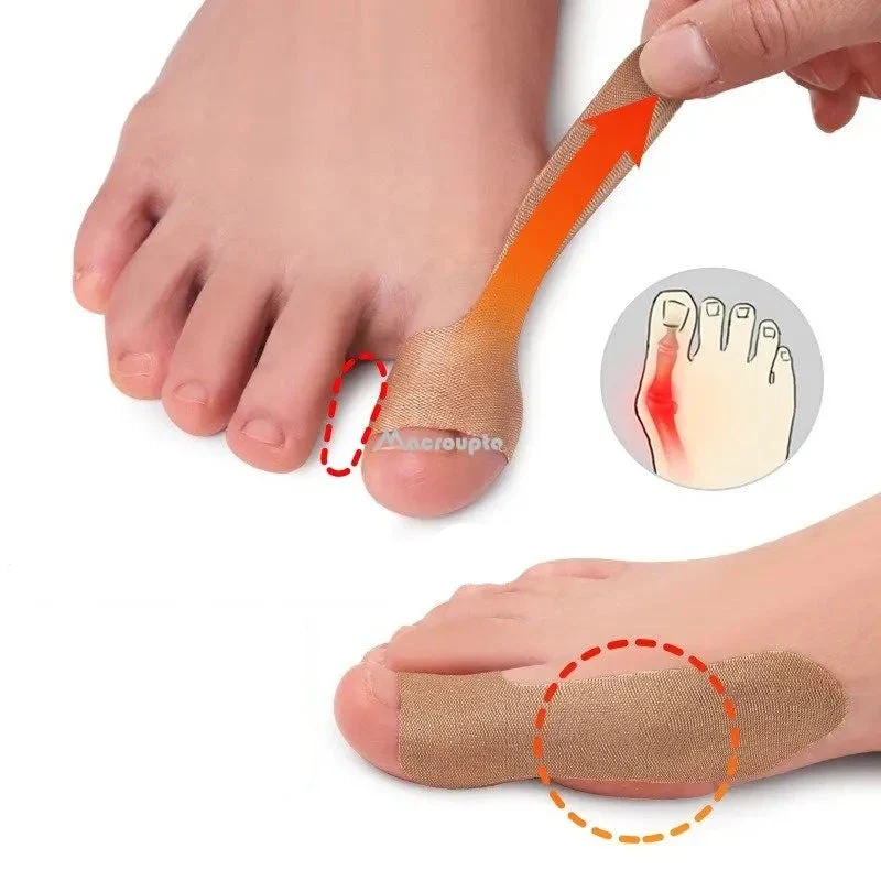 Orthese doigt de pied – Image 4