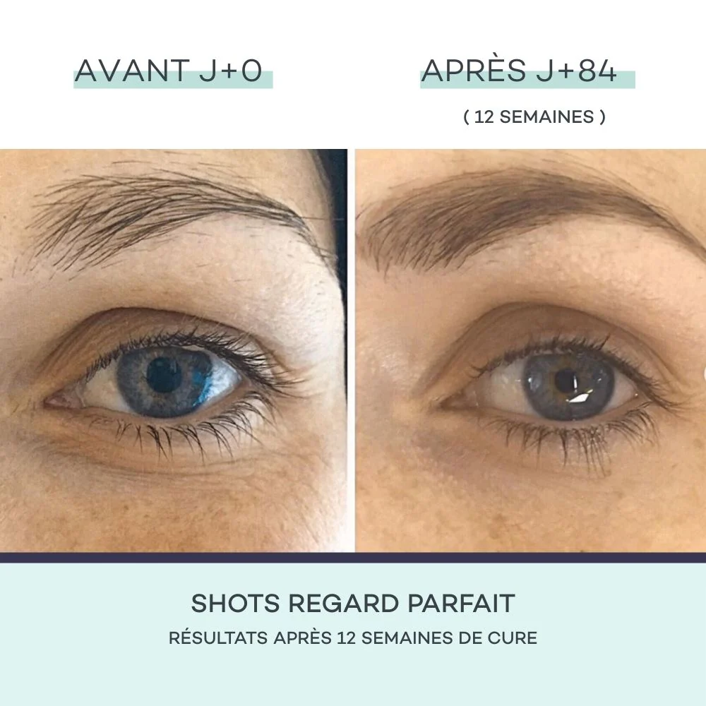 Shots Contour des Yeux – Image 3